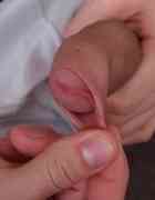 Axel Pierce at Fore-Skin